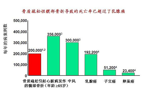 骨密度分析仪检测发现骨质疏松，要预防这些部位的骨折