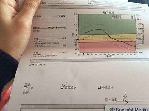 骨质疏松症与骨密度检测仪