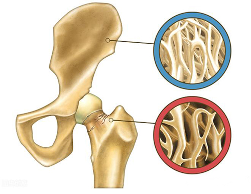 骨密度情况是评价人类健康状况的重要指标