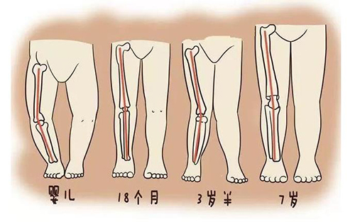 婴儿腿不直是因为缺钙吗？有必要进行超声骨密度仪检测吗？